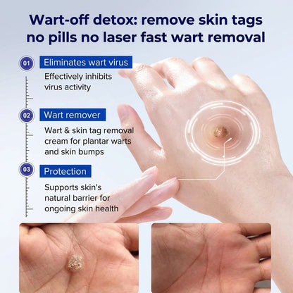 𝐏𝐡𝐚𝐫𝐦𝐚𝐜𝐢𝐬𝐭 𝐑𝐞𝐜𝐨𝐦𝐦𝐞𝐧𝐝𝐞𝐝 ✅𝐇𝐞𝒂𝒍𝗿𝗶𝙯𝙚® 🖊 𝐀𝐝𝐯𝐚𝐧𝐜𝐞𝐝 𝐖𝐚𝐫𝐭 & 𝐒𝐤𝐢𝐧 𝐓𝐚𝐠 𝐑𝐞𝐦𝐨𝐯𝐚𝐥 𝐏𝐞𝐧 — 𝐒𝐦𝐨𝐨𝐭𝐡-𝐋𝐨𝐨𝐤𝐢𝐧𝐠 𝐒𝐤𝐢𝐧 𝐢𝐧 𝟕 𝐃𝐚𝐲𝐬💪(Zero 𝐏𝐚𝐢𝐧, Zero 𝐒𝐜𝐚𝒓𝒔 Rollerball)💪