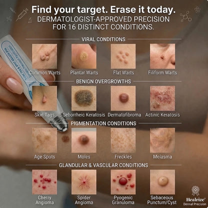 𝐏𝐡𝐚𝐫𝐦𝐚𝐜𝐢𝐬𝐭 𝐑𝐞𝐜𝐨𝐦𝐦𝐞𝐧𝐝𝐞𝐝 ✅𝐇𝐞𝒂𝒍𝗿𝗶𝙯𝙚® 🖊 𝐀𝐝𝐯𝐚𝐧𝐜𝐞𝐝 𝐖𝐚𝐫𝐭 & 𝐒𝐤𝐢𝐧 𝐓𝐚𝐠 𝐑𝐞𝐦𝐨𝐯𝐚𝐥 𝐏𝐞𝐧 — 𝐒𝐦𝐨𝐨𝐭𝐡-𝐋𝐨𝐨𝐤𝐢𝐧𝐠 𝐒𝐤𝐢𝐧 𝐢𝐧 𝟕 𝐃𝐚𝐲𝐬💪(Zero 𝐏𝐚𝐢𝐧, Zero 𝐒𝐜𝐚𝒓𝒔 Rollerball)💪