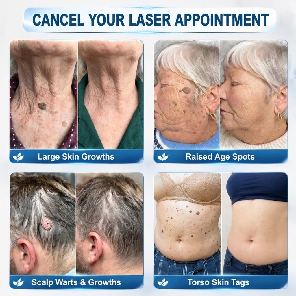 𝐏𝐡𝐚𝐫𝐦𝐚𝐜𝐢𝐬𝐭 𝐑𝐞𝐜𝐨𝐦𝐦𝐞𝐧𝐝𝐞𝐝 ✅𝐇𝐞𝒂𝒍𝗿𝗶𝙯𝙚® 🖊 𝐀𝐝𝐯𝐚𝐧𝐜𝐞𝐝 𝐖𝐚𝐫𝐭 & 𝐒𝐤𝐢𝐧 𝐓𝐚𝐠 𝐑𝐞𝐦𝐨𝐯𝐚𝐥 𝐏𝐞𝐧 — 𝐒𝐦𝐨𝐨𝐭𝐡-𝐋𝐨𝐨𝐤𝐢𝐧𝐠 𝐒𝐤𝐢𝐧 𝐢𝐧 𝟕 𝐃𝐚𝐲𝐬💪(Zero 𝐏𝐚𝐢𝐧, Zero 𝐒𝐜𝐚𝒓𝒔 Rollerball)💪
